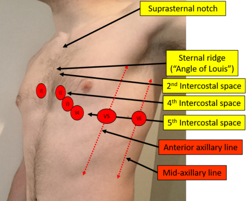 ECG